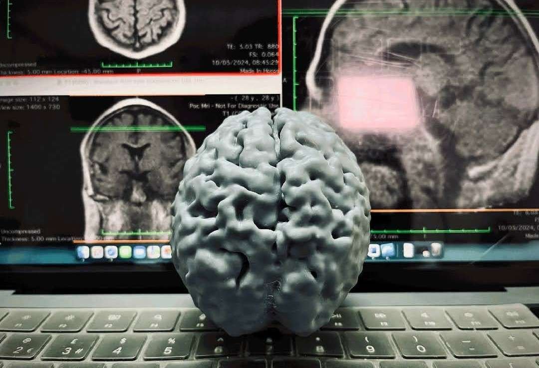 SLA 3D printed anatomical model